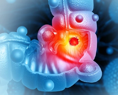 ¿Cómo se diagnostica el cáncer colorrectal?