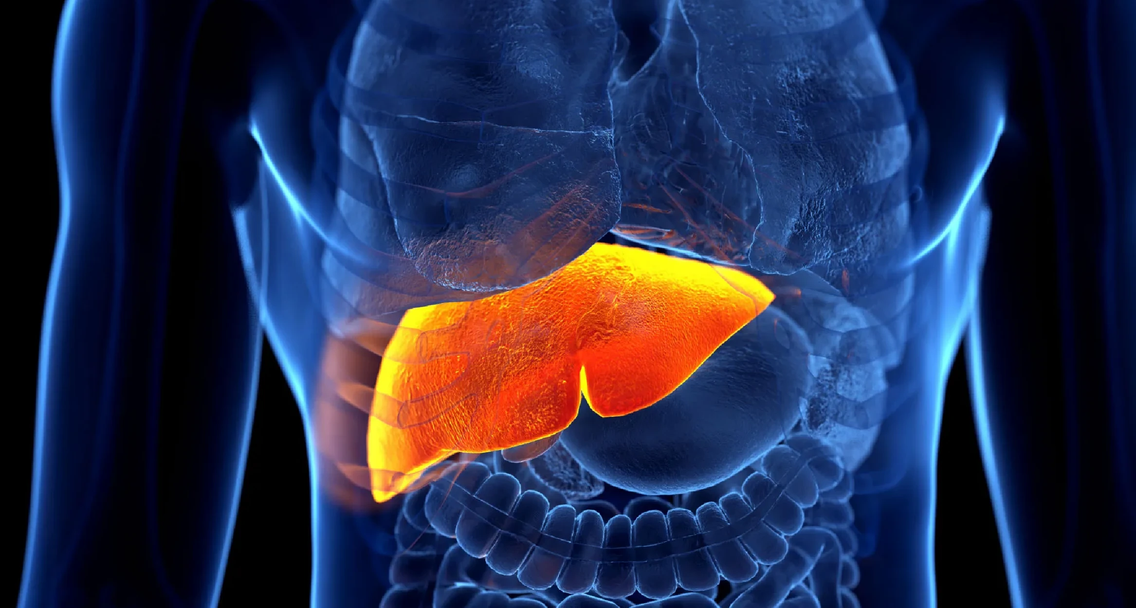 hígado graso no alcohólico