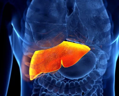 ¿Cómo tratar el hígado graso no alcohólico?