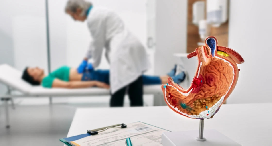 cancer gástrico: guía diagnóstico y tratamiento