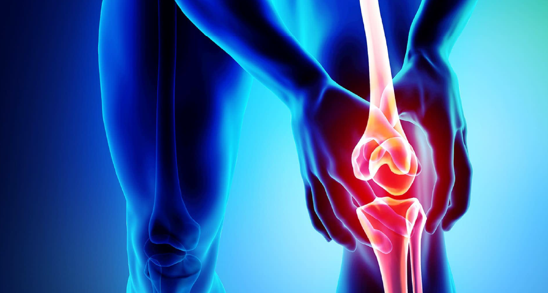 osteoartritis diagnóstico