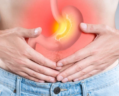 pirosis enfermedad y tratamiento