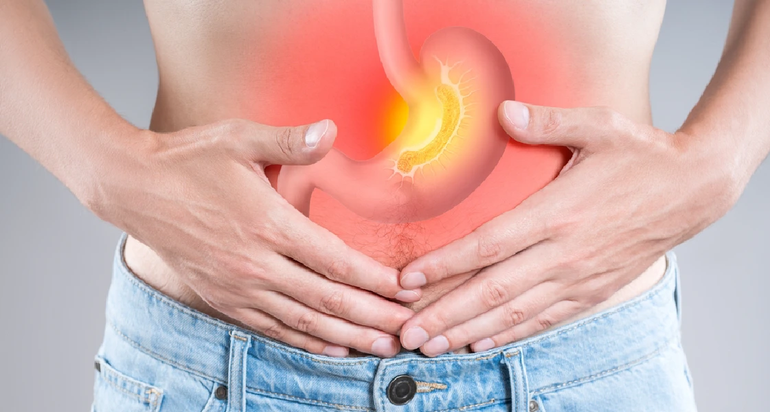 pirosis qué es y cómo tratar a pacientes que lo tienen