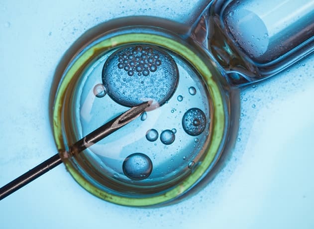 Fertilización in vitro